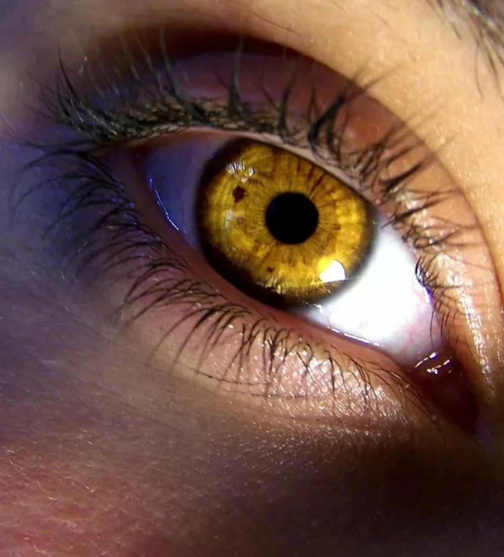 Описание желтых глаз. Центральная гетерохромия карих глаз. Центральная гетерохромия глаз Карий и зеленый. Центральная гетерохромия зеленых глаз с желтыми. Болотный цвет глаз гетерохромия.