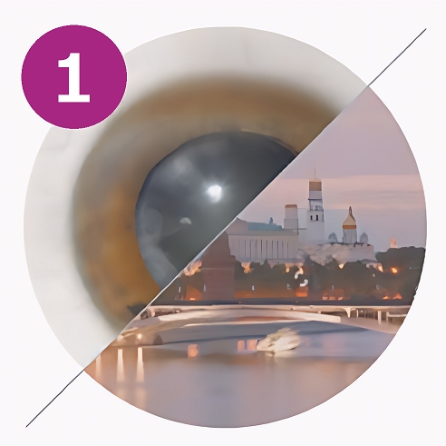 начальная стадия катаракты фото