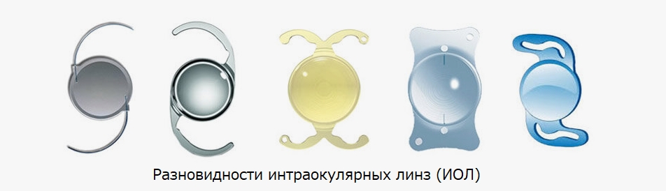 интраокулярные линзы пример фото