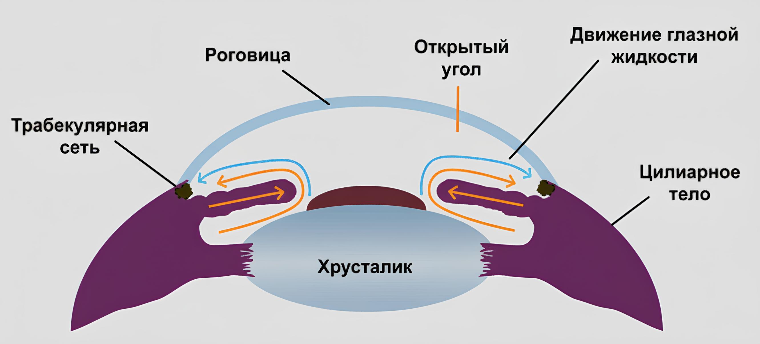 открытоугольная глаукома фото