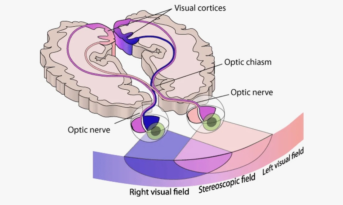 развитие амблиопии